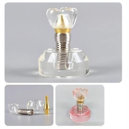 3 in 1 Implant Model